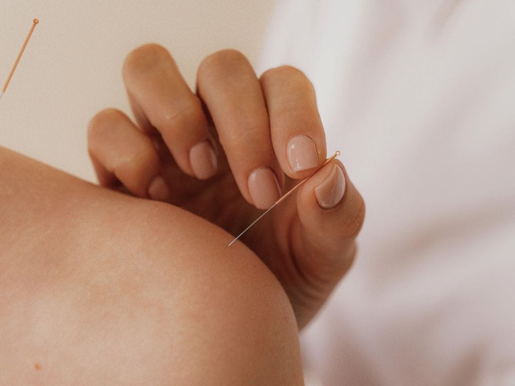 acupuncture tcm clinic